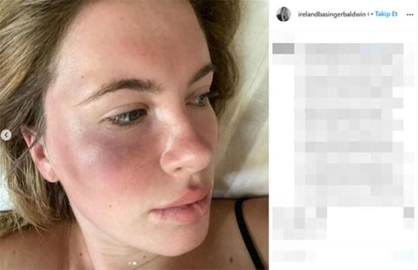 Ireland Baldwin orada ortaya çıktı