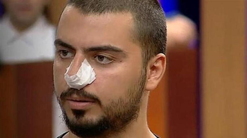 MasterChef Serhat'ın burnuna ne oldu? Herkes merak ediyor...