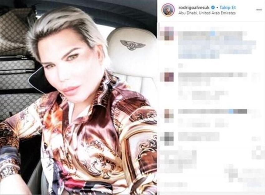 Rodrigo Alves cinsiyet değiştirdi