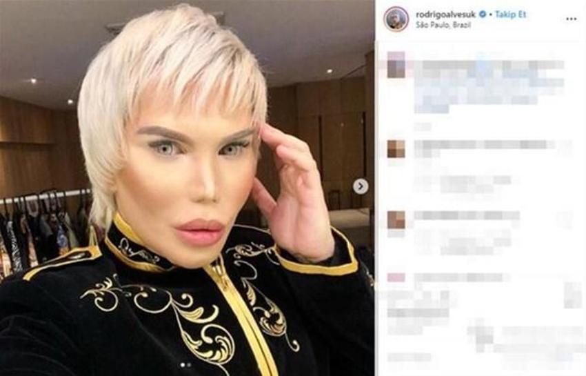 Rodrigo Alves cinsiyet değiştirdi
