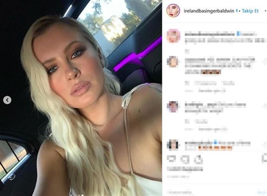 Ireland Baldwin