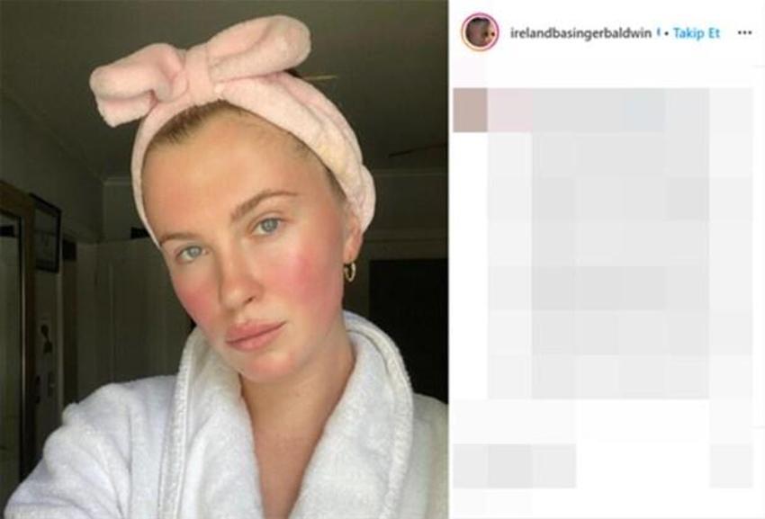 Ireland Baldwin