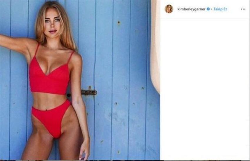 Kimberley Garner