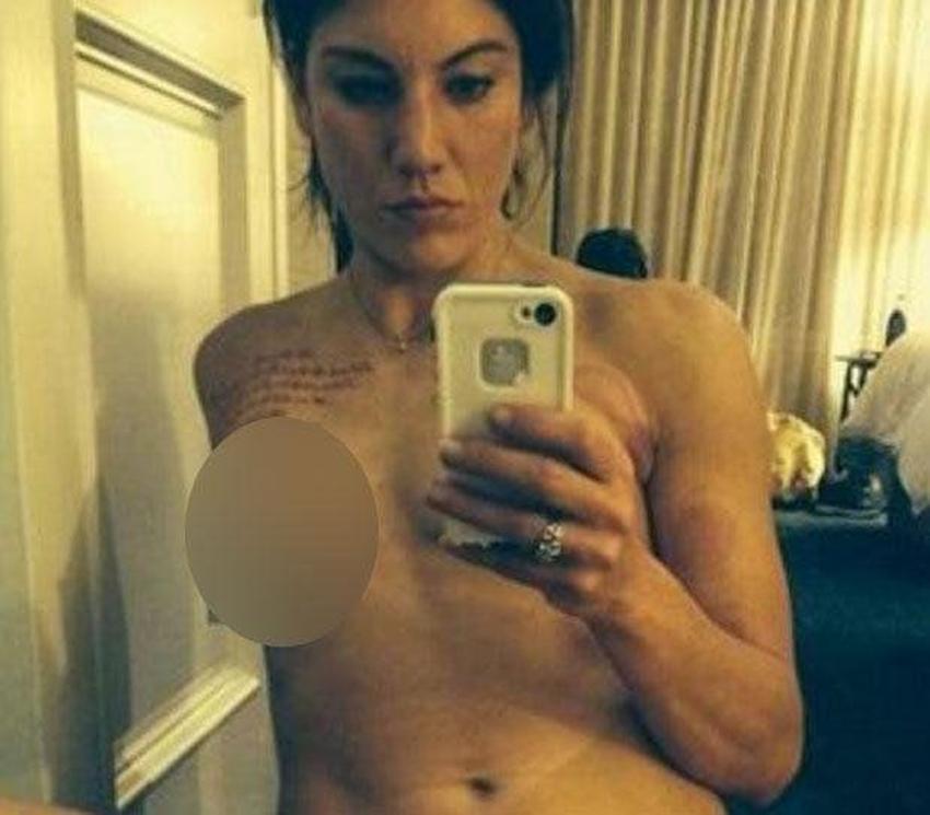 Hope Solo: Blatter beni taciz etti!