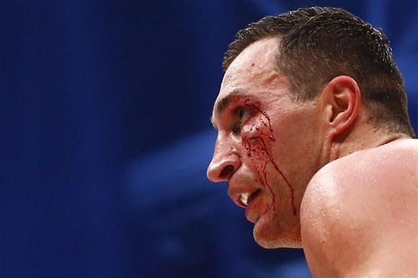 Şampiyon Tyson Fury!