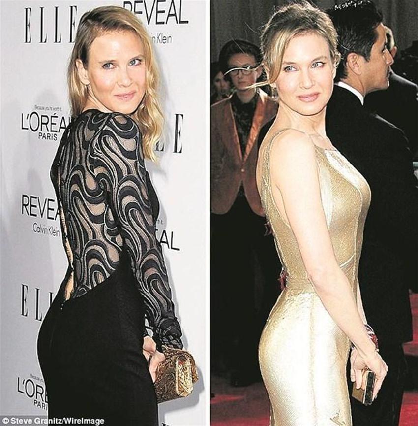 Renee Zellweger tanınmayacak halde