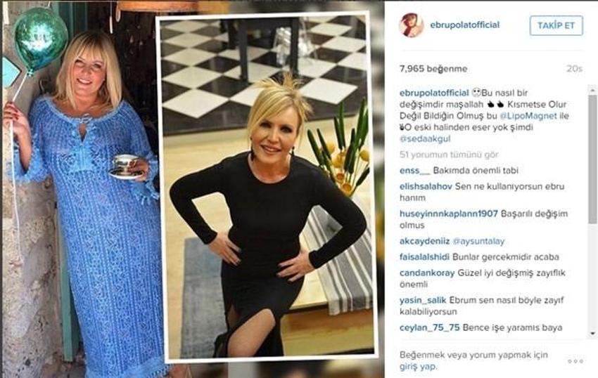 Zeynep Koçak bambaşka biri oldu! Görenler tanıyamıyor