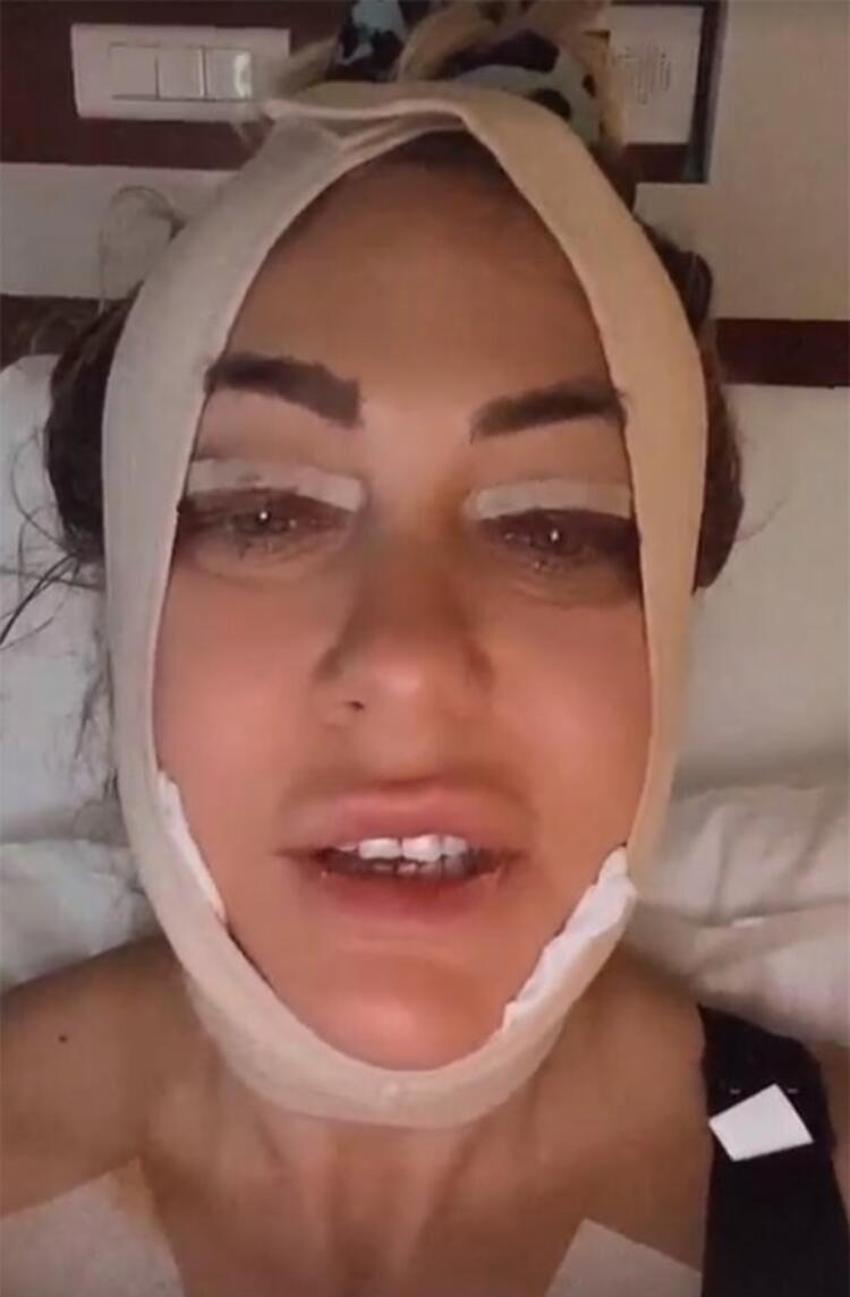 Yeliz Yeşilmen'in şaşırtan değişimi! Gören tanıyamadı!