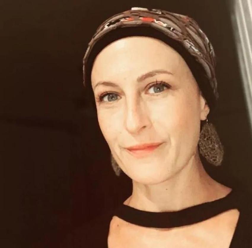 Kanser tedavisi gören Canan Ergüder'in son hali...