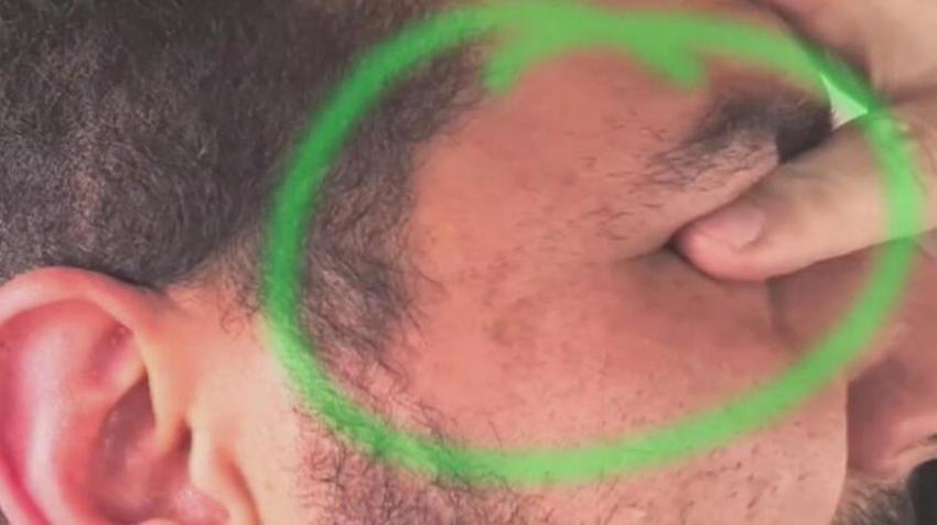 'Dayaklı' tedavi skandalında flaş gelişme! Yeni görüntüler iğrenç