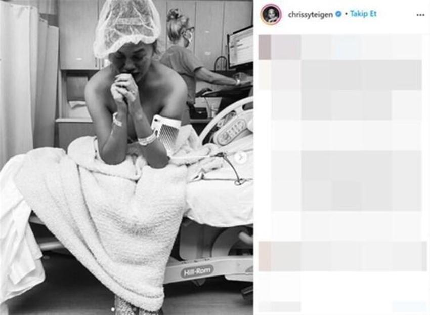 Chrissy Teigen: Hayal edebileceğim en büyük acıyı verdim