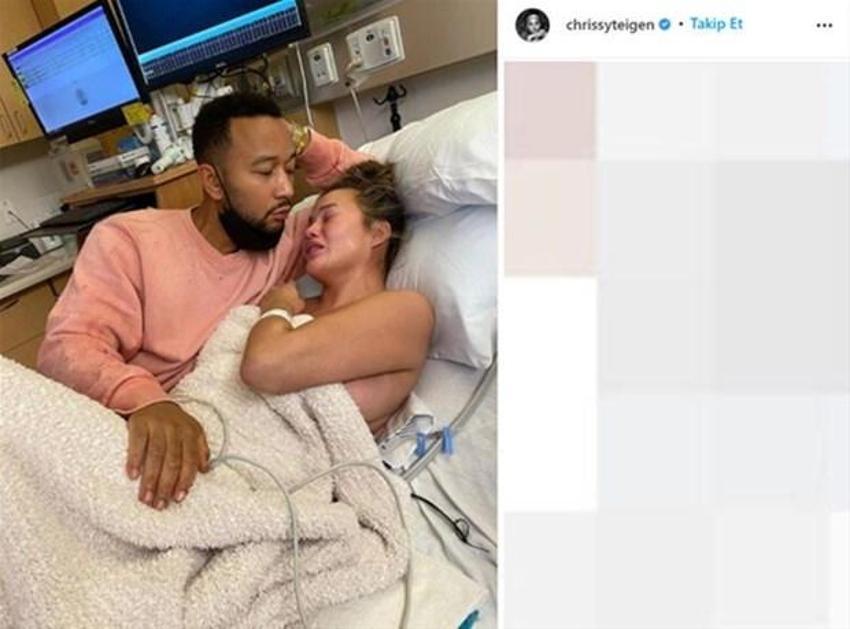 Chrissy Teigen: Hayal edebileceğim en büyük acıyı verdim