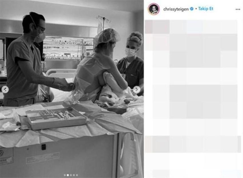 Chrissy Teigen: Hayal edebileceğim en büyük acıyı verdim