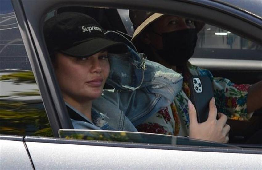 Chrissy Teigen yanaklarındaki yağları aldırdı