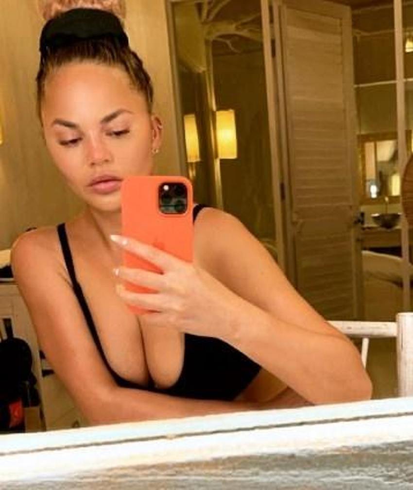 Chrissy Teigen yanaklarındaki yağları aldırdı