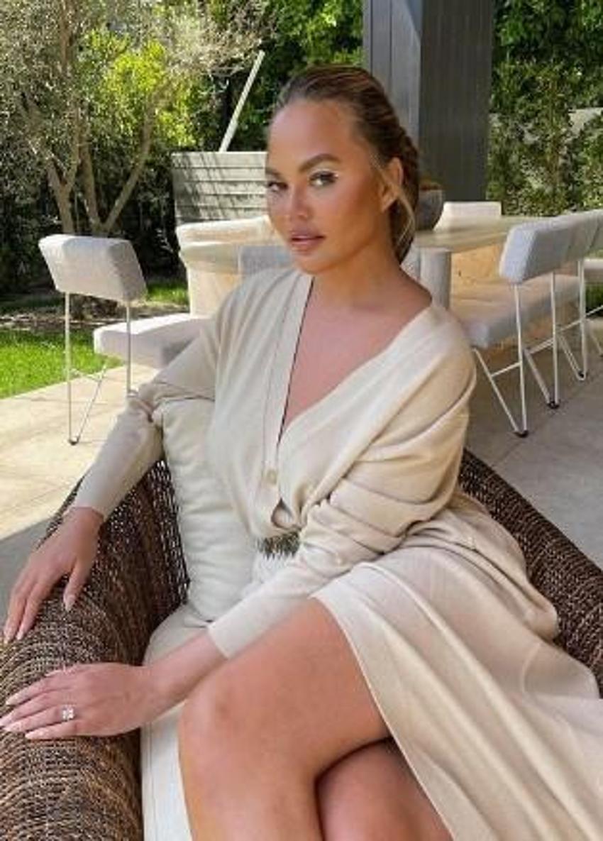Chrissy Teigen yanaklarındaki yağları aldırdı