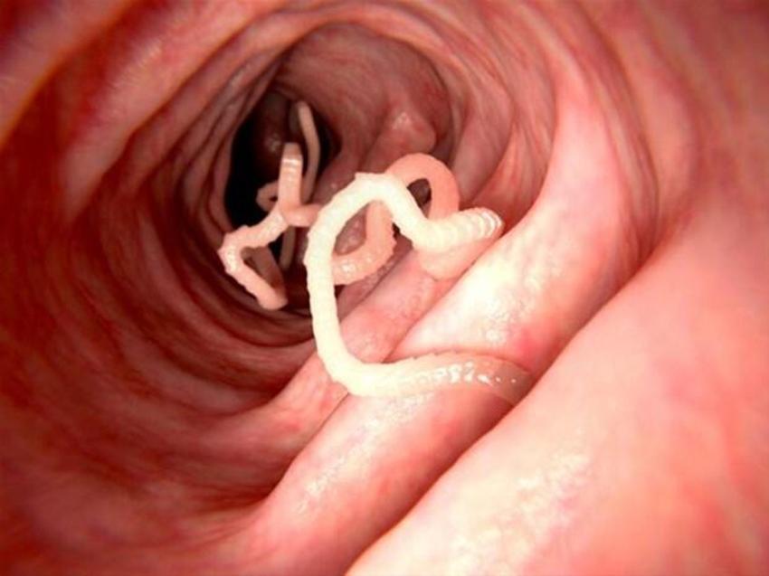 İnsan içinde 20 yıl yaşıyor, hayvandan geçiyor! Beyni tamamen ele geçiriyor