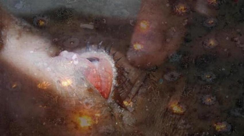 'Gizemli hastalık' öldürüyor! Dünya panikte, yayılıyor