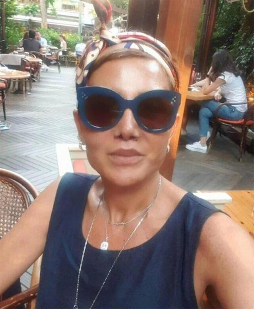 Serap Paköz estetik sonrası ilk kez paylaştı! Son hali...