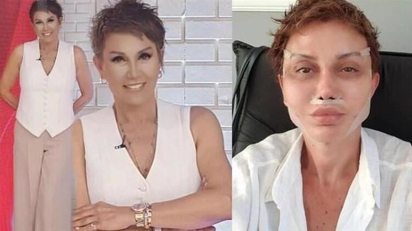 Serap Paköz estetik sonrası ilk kez paylaştı! Son hali...