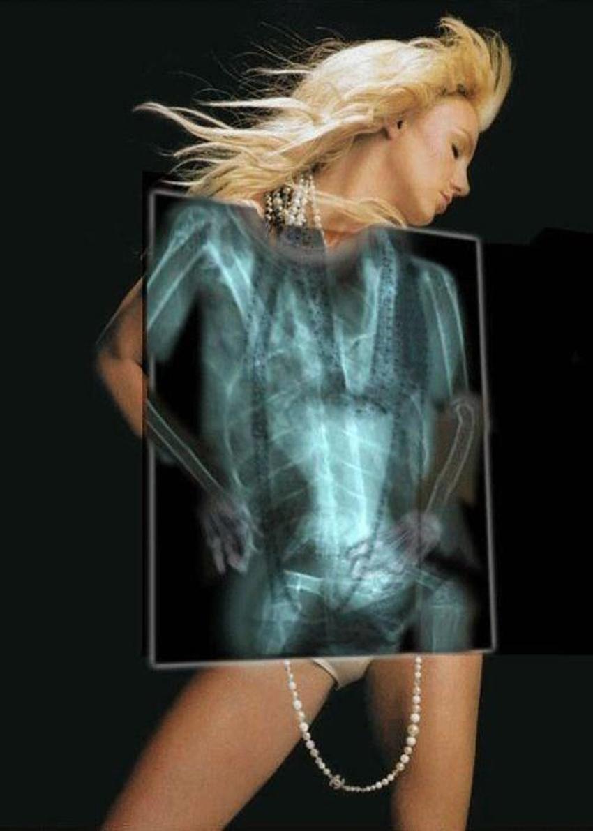 Xray altında