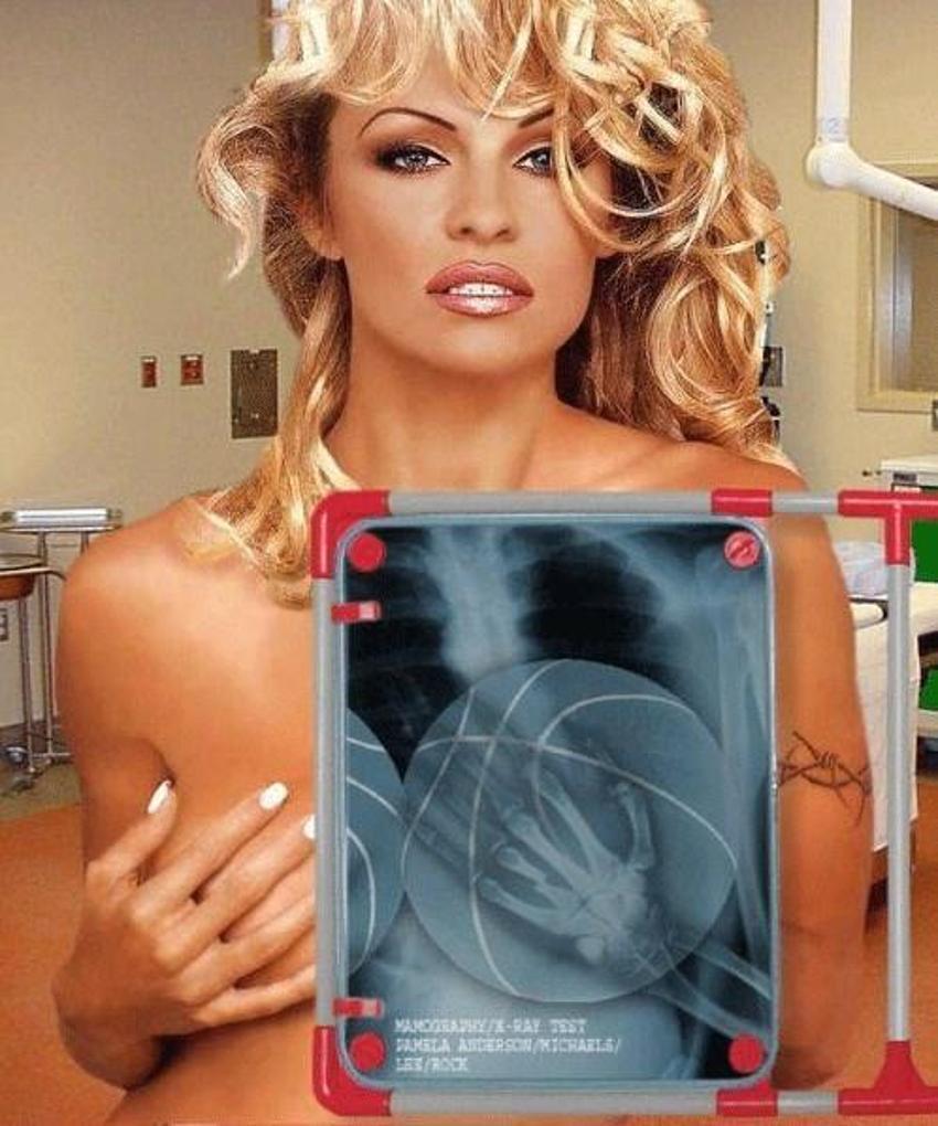 Xray altında