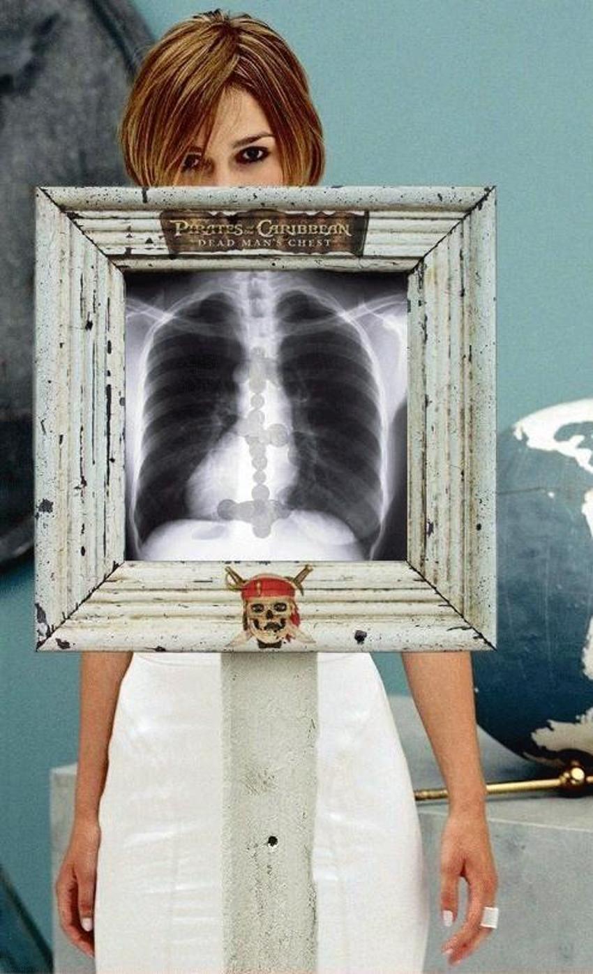 Xray altında