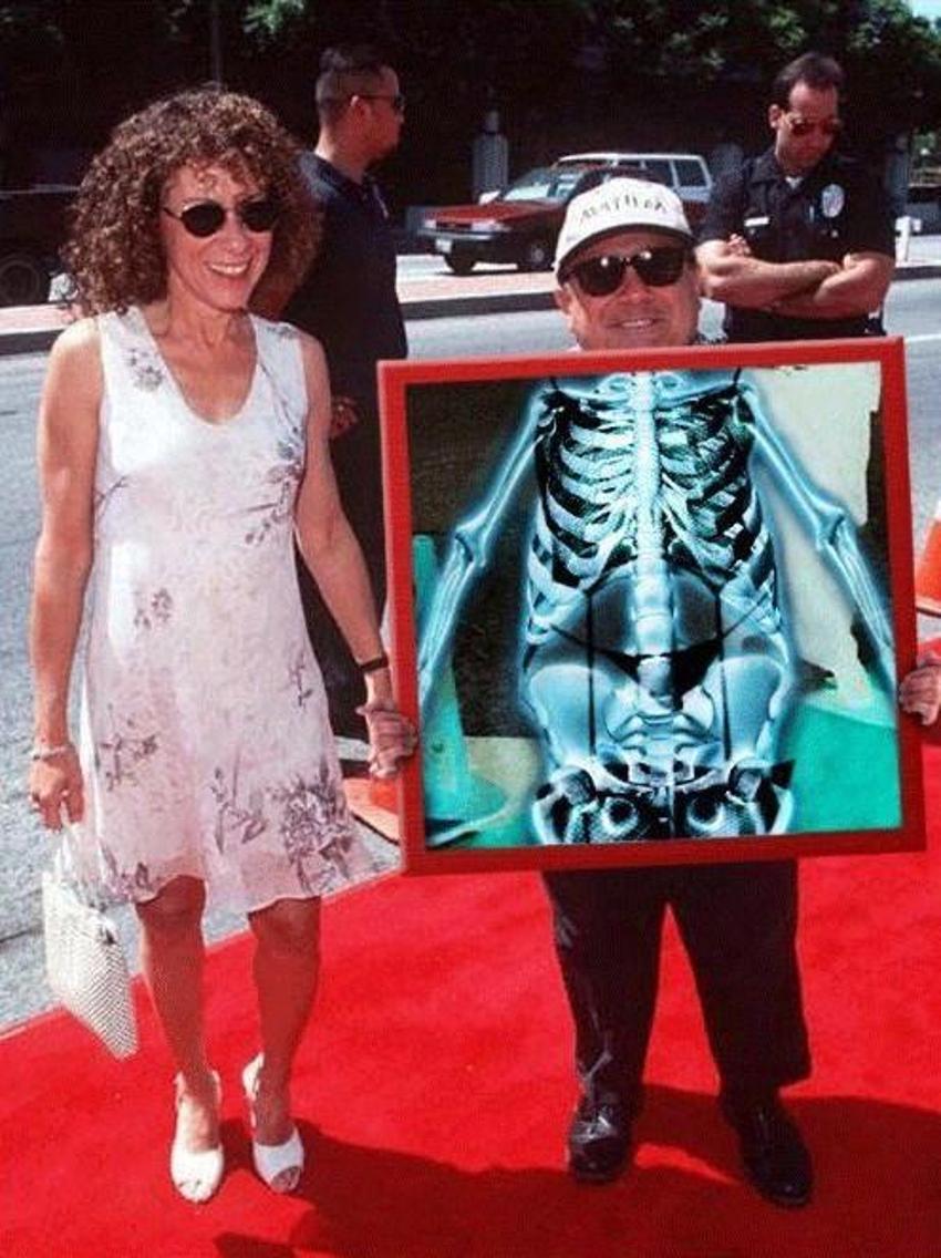 Xray altında