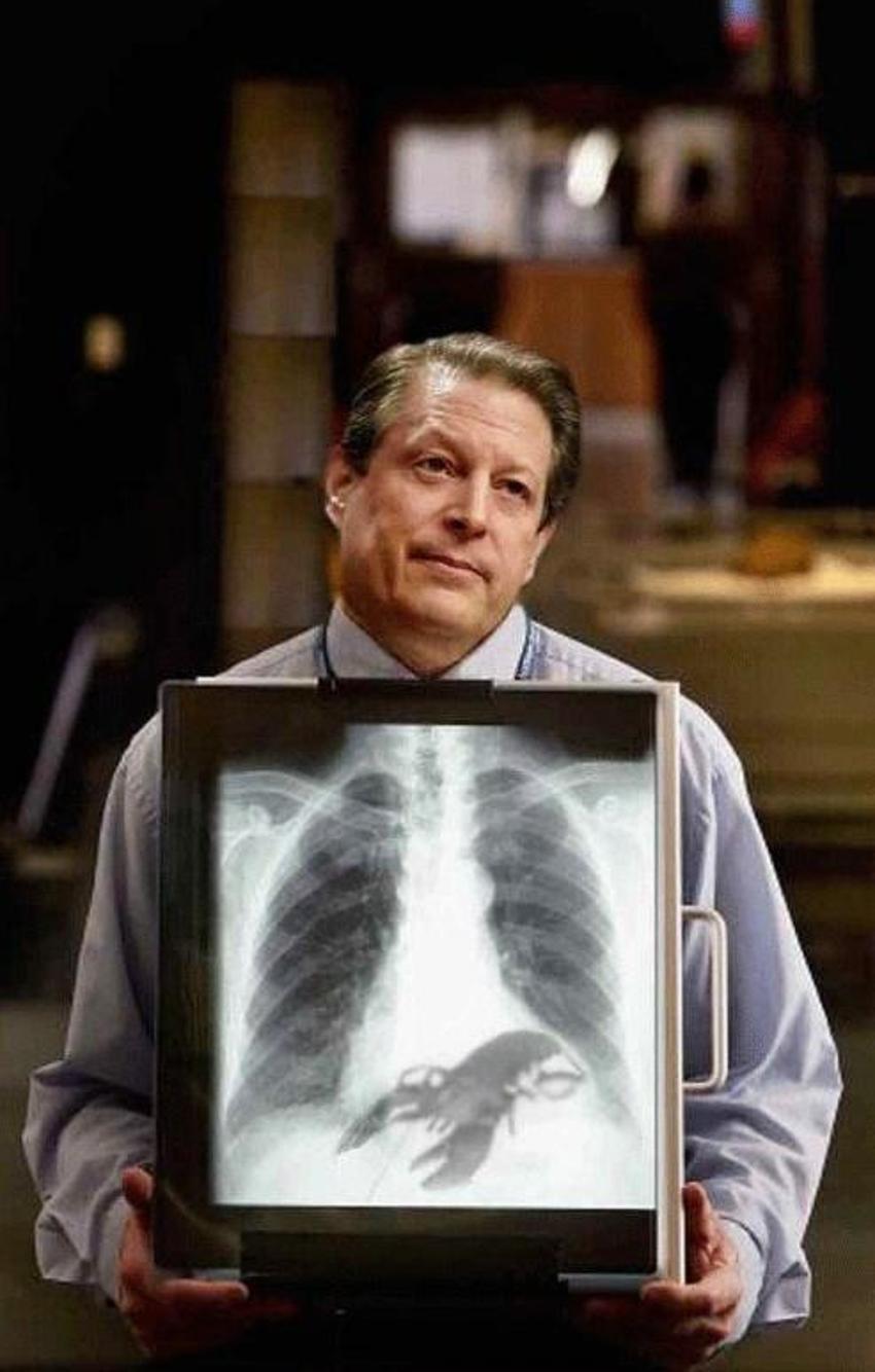 Xray altında