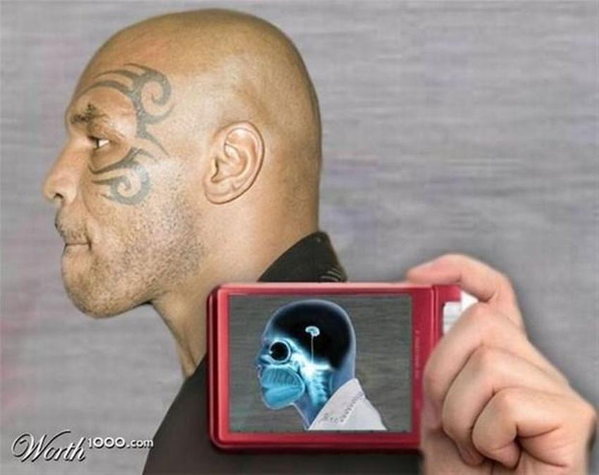 Xray altında