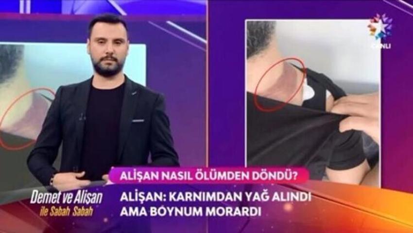 'Ölümden döndüm' demişti! Alişan 2 milyon TL'lik dava açtı