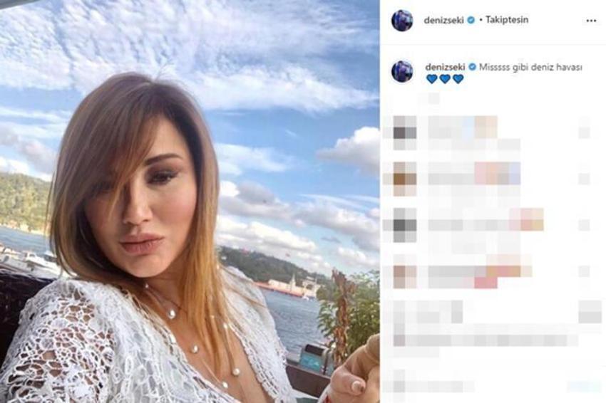 Deniz Seki yüzündeki şişliğin sebebini açıkladı!