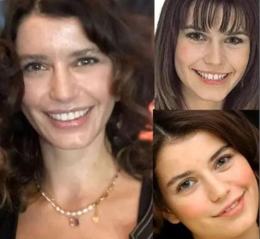 Estetikli ünlüler