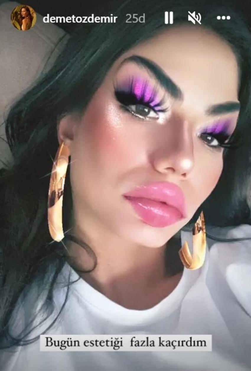 Demet Özdemir'in yüzündeki değişim dikkat çekti! 'Estetiği fazla kaçırdım'