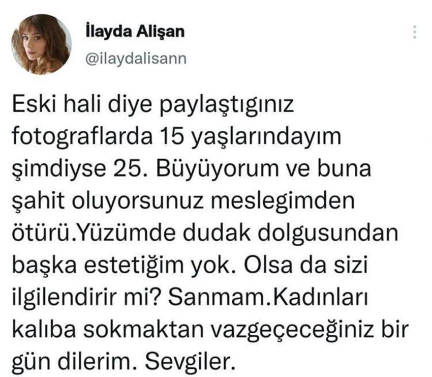 İlayda Alişan'dan estetik açıklaması!