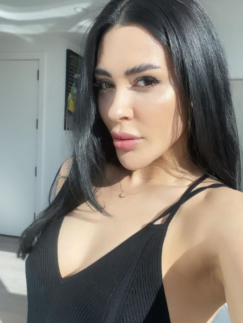 Ayşegül Doğan'dan yeni poz! Estetik harikası...
