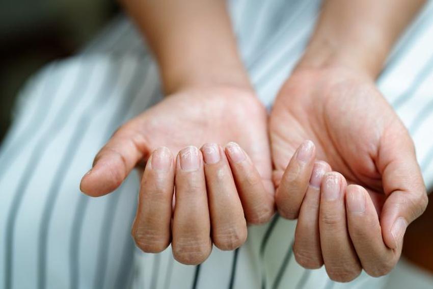 Diyabetle savaşıyor, doğal insülin görevi görüyor! O hastalığı bir saatte iyi ediyor