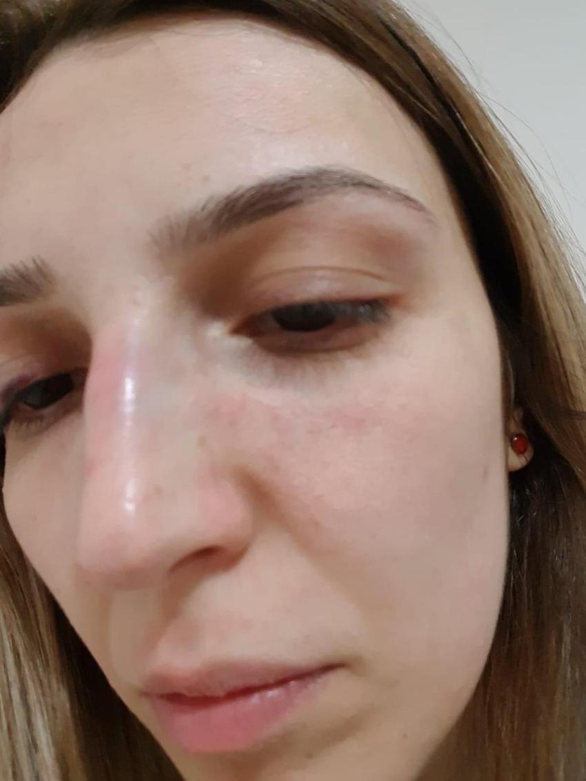 Hastalıklı ilişki! Muhtardan eski sevgilisine çıplak fotoğraf şantajı