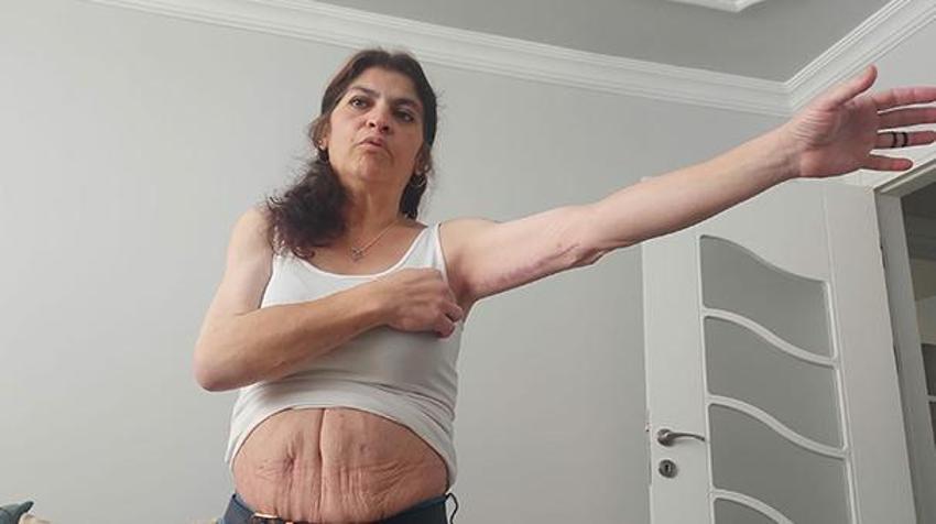 Estetik operasyon kabusu! Peş peşe 3 kez denedi, görünce kendi bile inanamadı