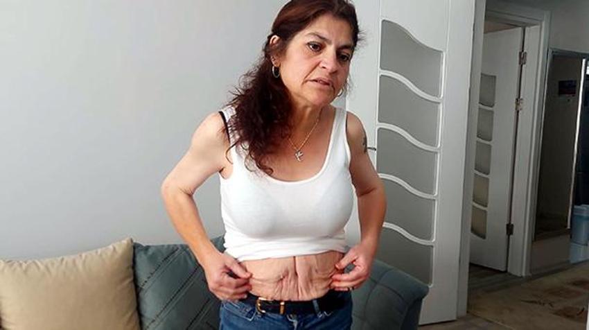 Estetik operasyon kabusu! Peş peşe 3 kez denedi, görünce kendi bile inanamadı