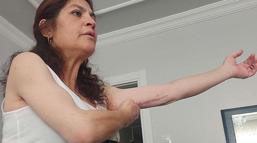 Estetik operasyon kabusu! Peş peşe 3 kez denedi, görünce kendi bile inanamadı