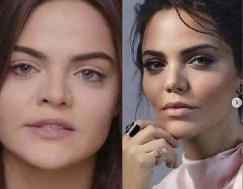 Bir Zamanlar Çukurova'nın Züleyha'sı Hilal Altınbilek'in eski hali şoke etti!