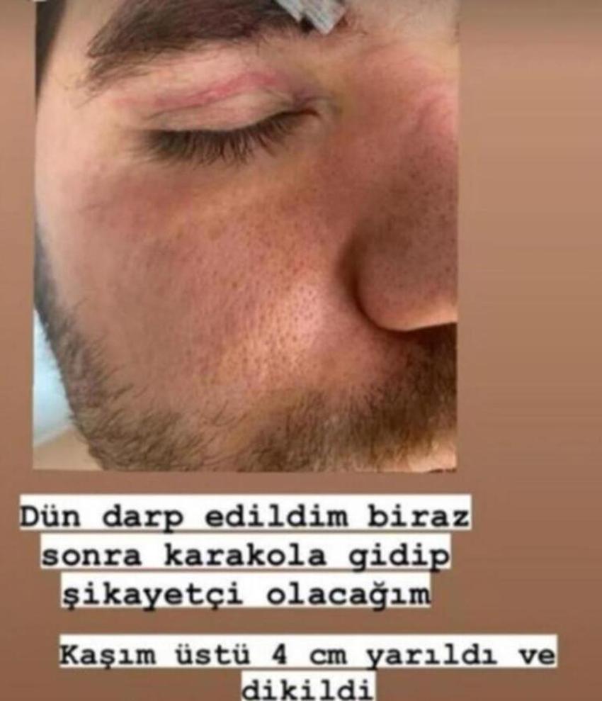Ceyhun Fersoy-Begüm Öner çiftine saldırı anı kameraya yansıdı!