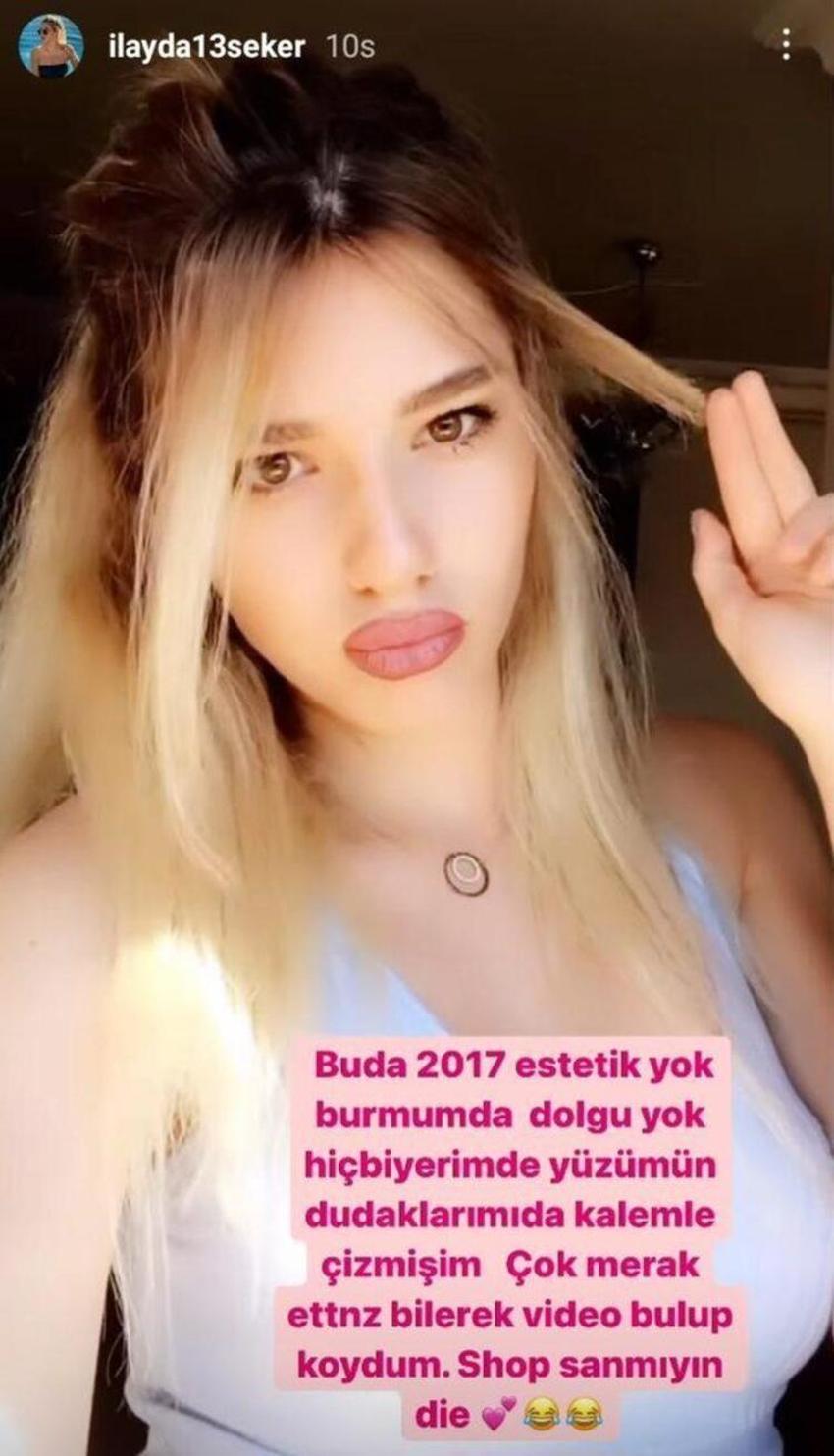 Survivor İlayda Şeker'in estetiksiz hali! Sosyal medya hesabından paylaştı