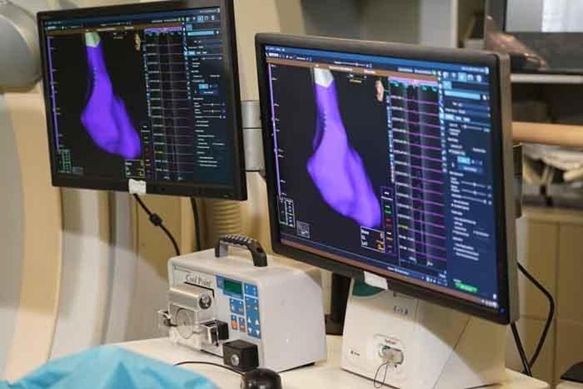 Kalp hastaları için mucize gerçekleşti! Kalp pili resmen tarih oluyor, cardioneuroablasyon tekniği...