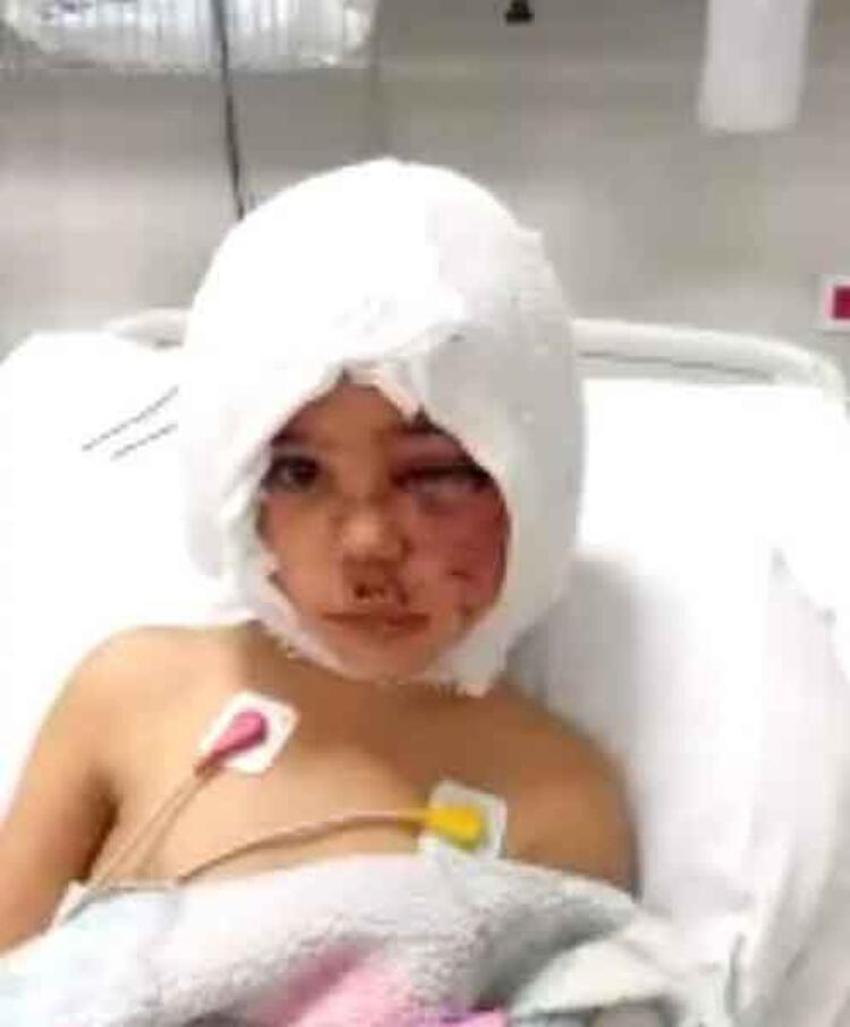 Pitbull saldırısına uğrayan Asiye Ateş'le ilgili son dakika gelişmesi!