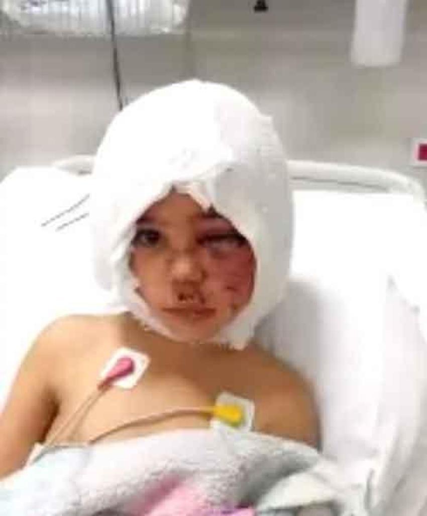Pitbull saldırısına uğrayan Asiye Ateş’in sağlık durumunda yeni gelişme