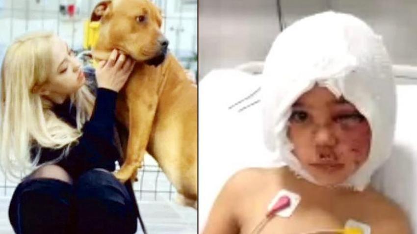 Asiye Ateş olayı ile ilgili skandal iddia! Pitbull saldırısı sonrası...