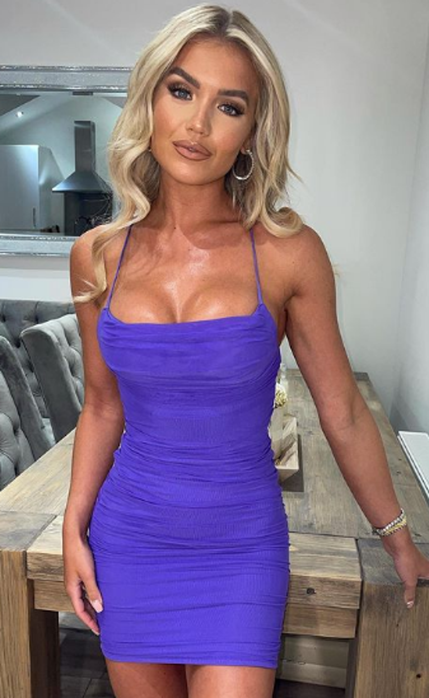 Love Island yıldızı itiraf etti! "Geçmişte onları hep dolguyla destekliyordum"