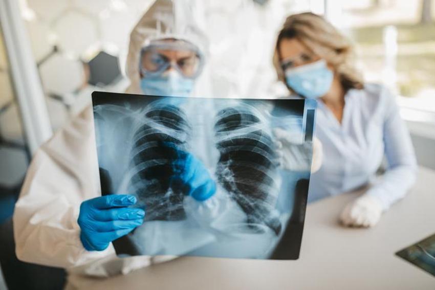 Akciğerleri koruyor, tam bir doğal bir antibiyotik! Detoks etkisi sağlıyor, kansere karşı savaşıyor